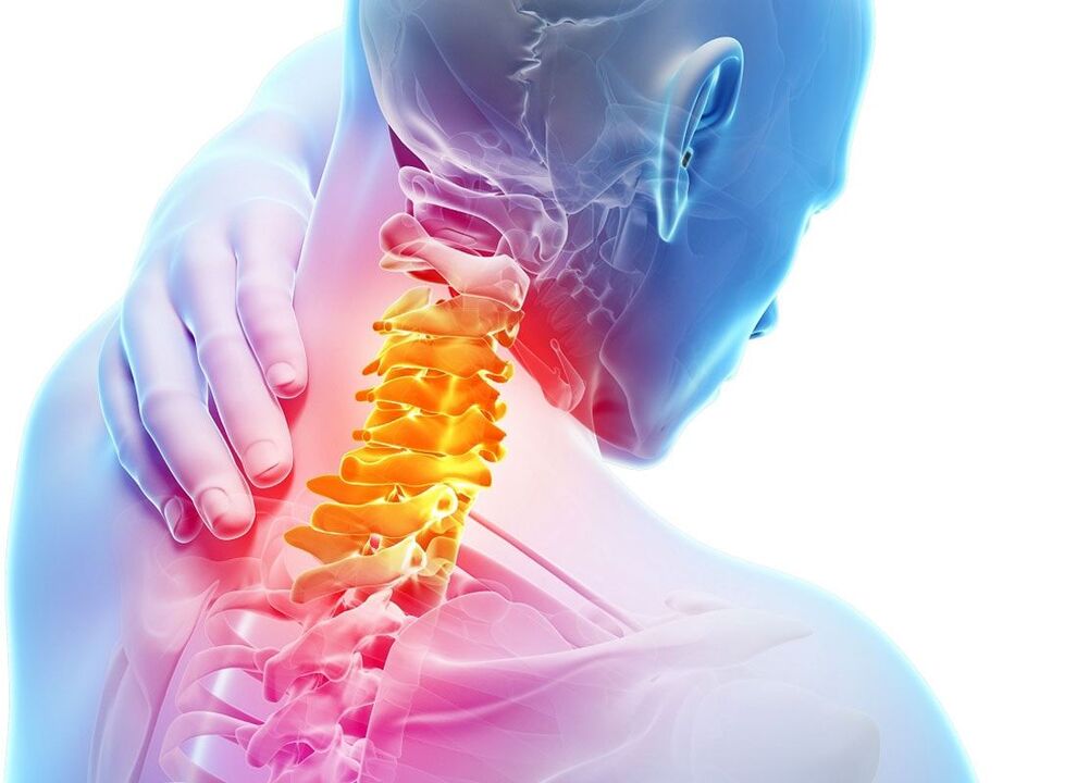 localizarea osteocondrozei